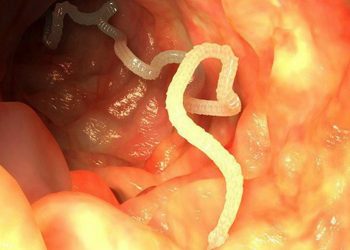 Giun - Ký sinh phổ biến nhất sống trong đường ruột con người