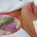 Hậu quả nghiêm trọng phá hủy cả gương mặt