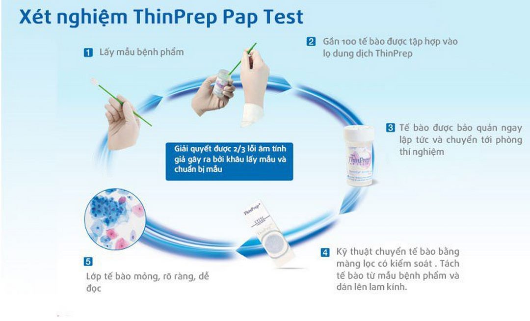 Xét nghiệm Thinprep - Phương pháp chẩn đoán HPV được sử dụng