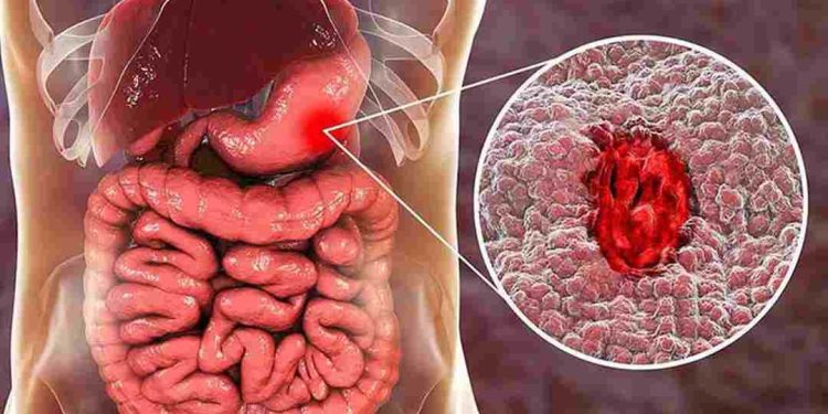 Phòng bệnh trước tiên hơn là phải chữa bệnh