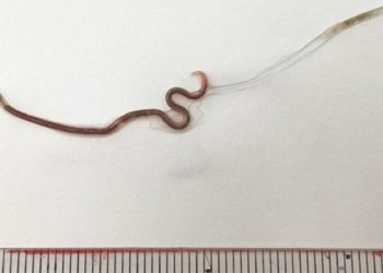 Nên nhìn vào hai mặt của loài giun màu đỏ này