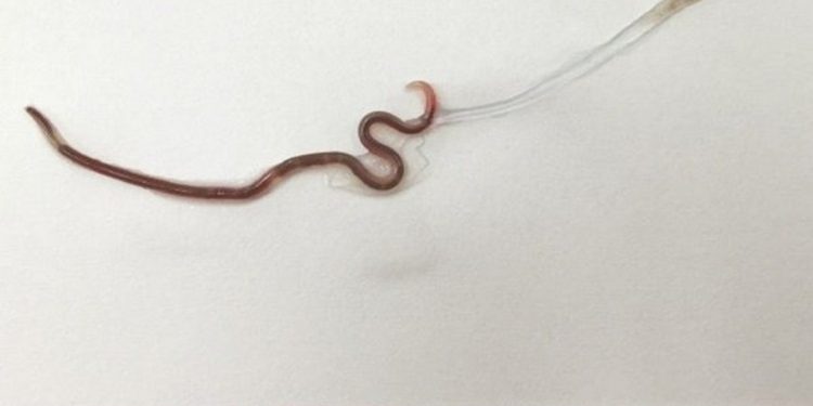 Nên nhìn vào hai mặt của loài giun màu đỏ này