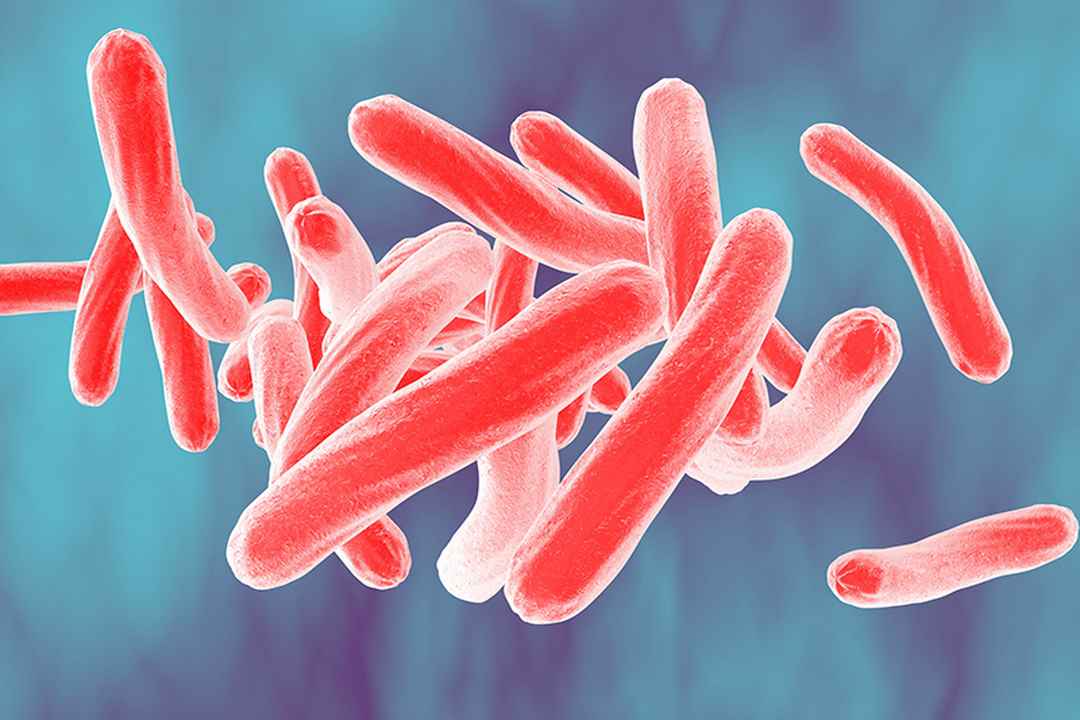 Các khuẩn cầu Mycobacterium Tuberculosis là căn nguyên của bệnh