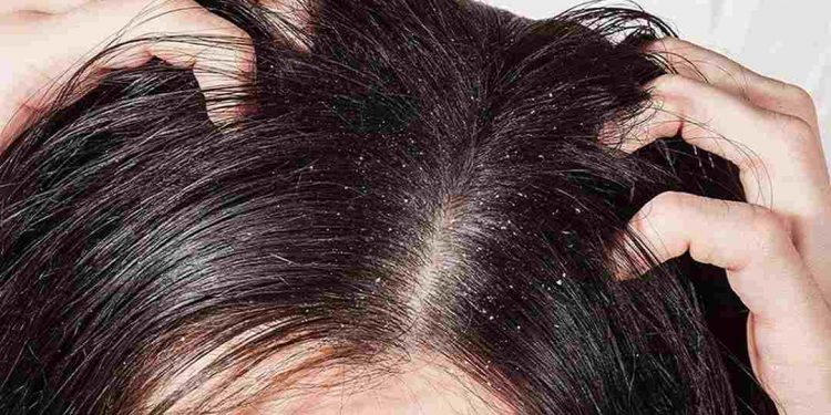 Bệnh lý da liễu gây phiền toái cho con người