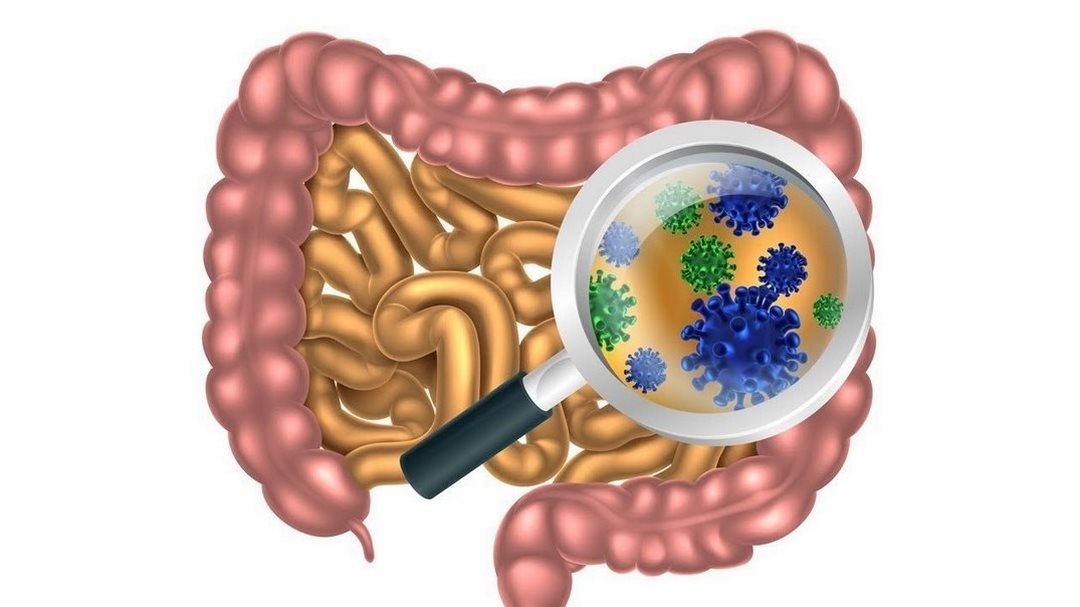 Góc nhìn tổng quan về nhiễm trùng đường ruột