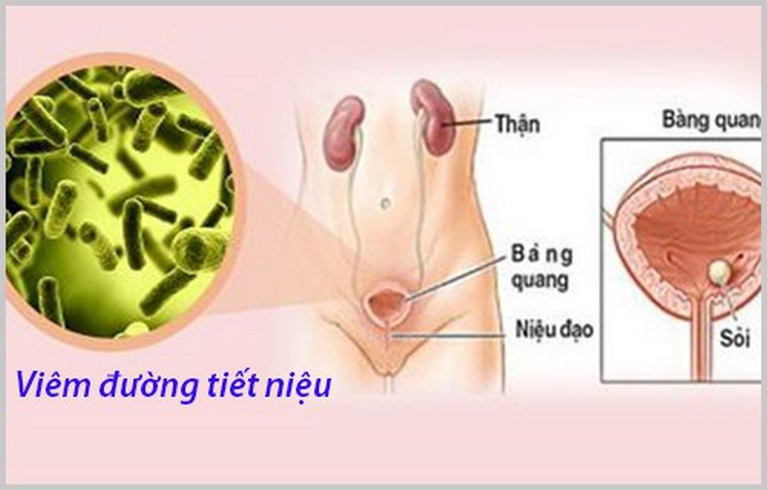 Hệ tiết niệu