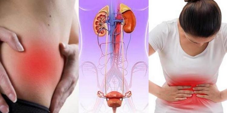 Hình ảnh bệnh về nhiễm trùng đường tiết niệu