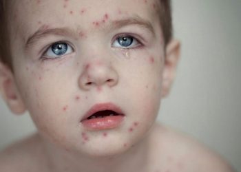 Điều trị đúng cách căn bệnh tránh gây nguy hiểm