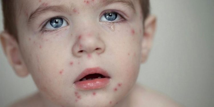 Điều trị đúng cách căn bệnh tránh gây nguy hiểm