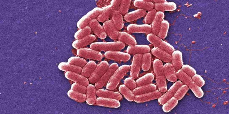 Vi khuẩn e coli nguy hiểm không? Biểu hiện khi nhiễm khuẩn?