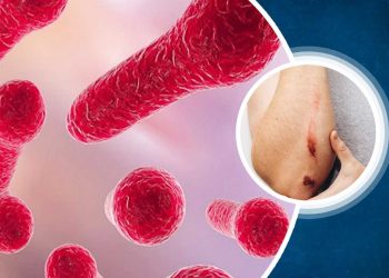 Tác nhân gây bệnh uốn ván là gì?