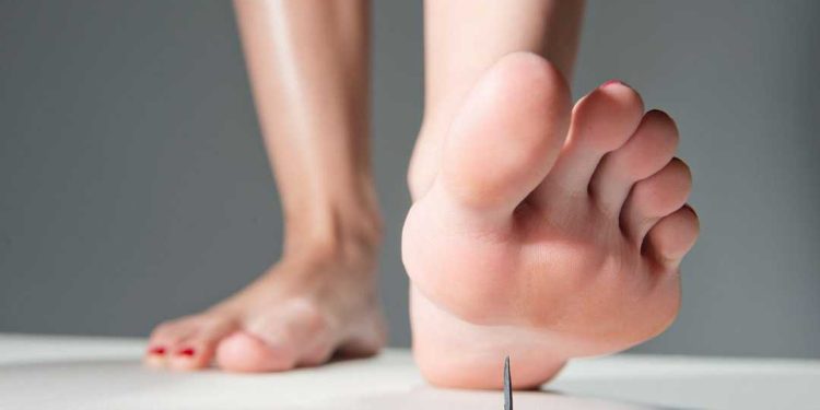 Nhiễm trùng uốn ván ủ bệnh bao lâu?