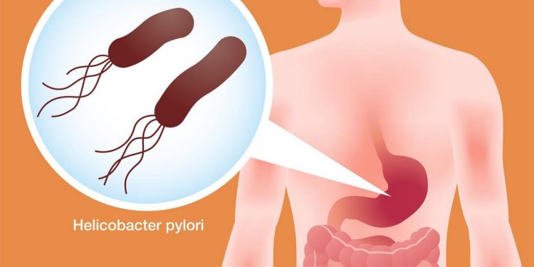 Cách để giảm nguy cơ lây nhiễm vi khuẩn HP