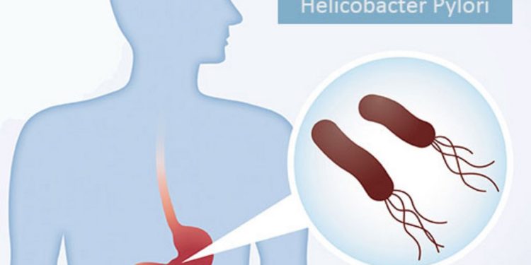 Tác động của Vi Khuẩn HP lên Hệ Tiêu Hóa của Người Bệnh