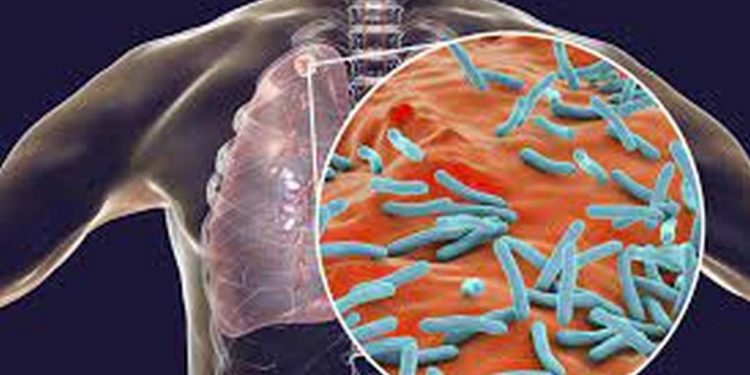 Điều trị Tuberculosis: Thuốc, Phương pháp chữa bệnh và Hồi phục