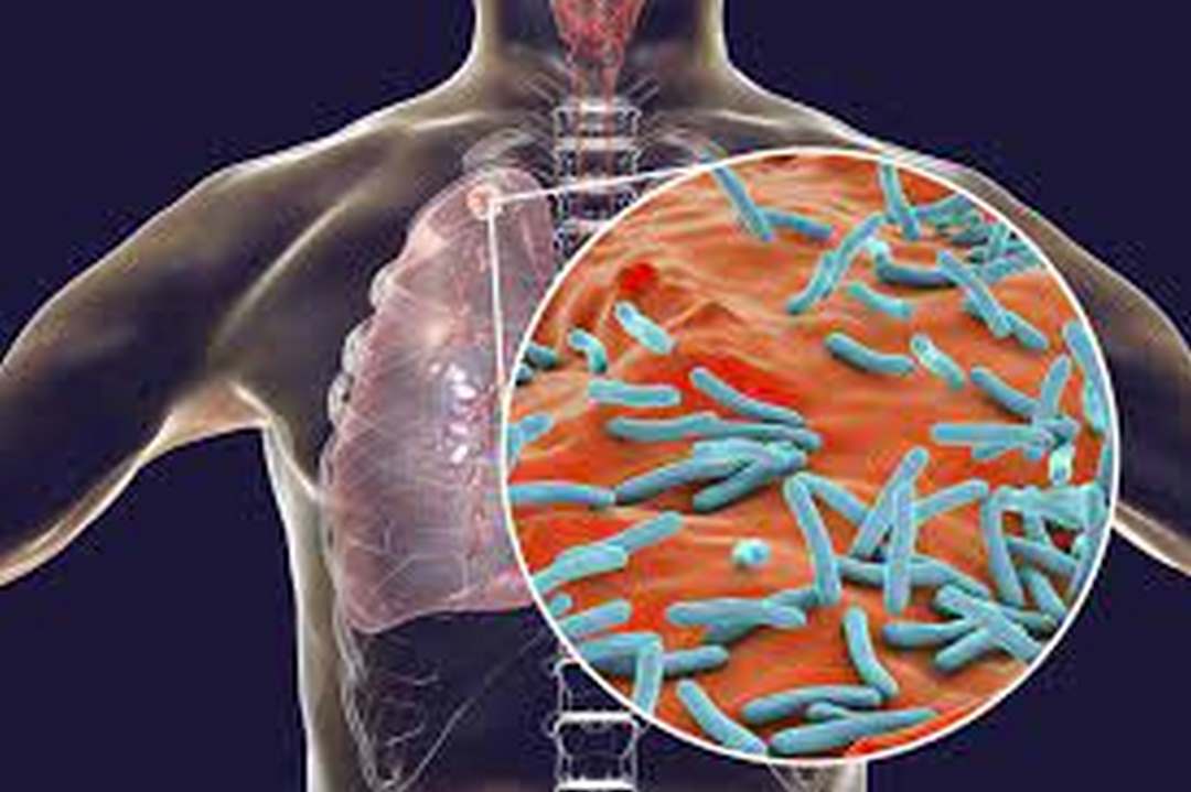 Điều trị Tuberculosis: Thuốc, Phương pháp chữa bệnh và Hồi phục