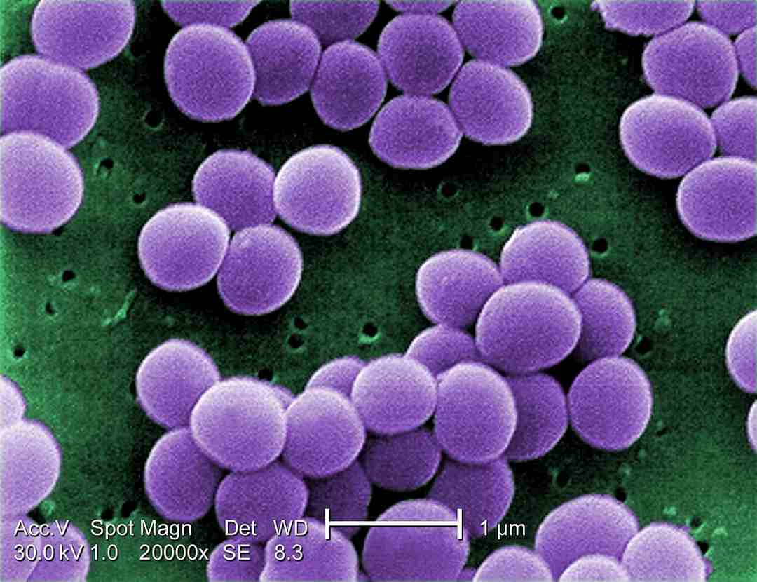 Giới thiệu về Vi khuẩn Staphylococcus aureus