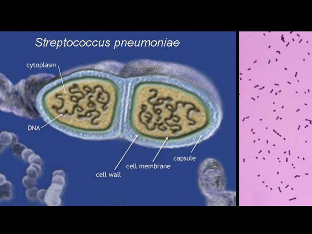 Giới thiệu về Vi khuẩn Streptococcus pneumoniae