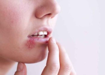 Triệu chứng bệnh do HSV gây ra