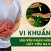 Tìm hiểu về triệu chứng và dấu hiệu nhiễm vi khuẩn HP