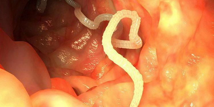 Giun - Ký sinh phổ biến nhất sống trong đường ruột con người