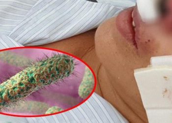 Hậu quả nghiêm trọng phá hủy cả gương mặt