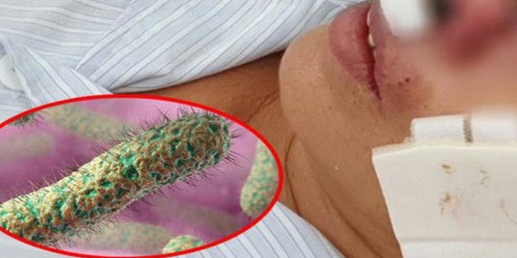 Hậu quả nghiêm trọng phá hủy cả gương mặt