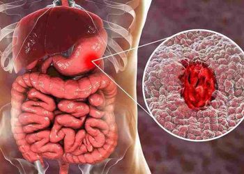 Phòng bệnh trước tiên hơn là phải chữa bệnh