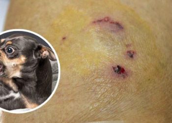 Thời gian phát triển của bệnh dại