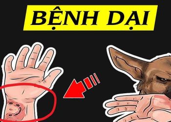 Cách nhận biết bệnh dại ở người theo từng thời kỳ