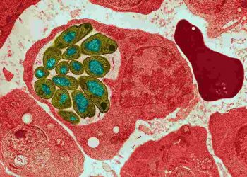 Trùng sốt rét, con đường truyền nhiễm và biện pháp ngăn chặn