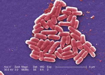 Vi khuẩn e coli nguy hiểm không? Biểu hiện khi nhiễm khuẩn?