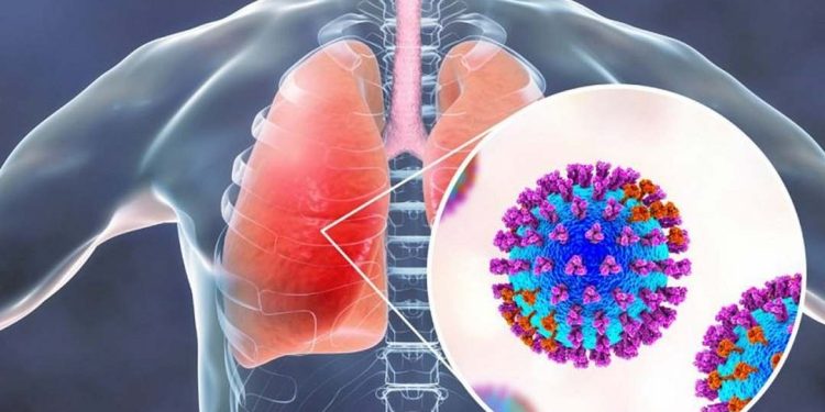 Biến chứng khi nhiễm phải virus RSV