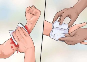 Hướng dẫn xử lý khi bị chó cắn để tránh bị dại