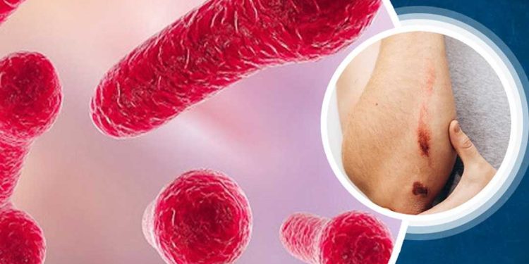 Tác nhân gây bệnh uốn ván là gì?