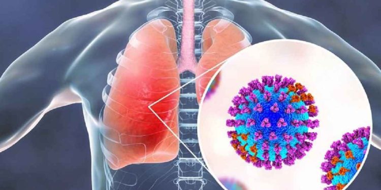 Hình ảnh virus RSV