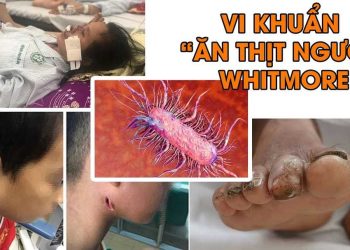 Vi khuẩn Whitmore được liệt vào danh sách vi khuẩn có tính khủng bố sinh học