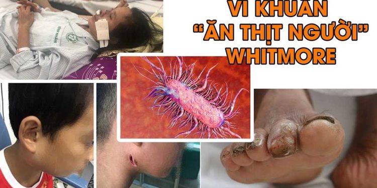 Vi khuẩn Whitmore được liệt vào danh sách vi khuẩn có tính khủng bố sinh học