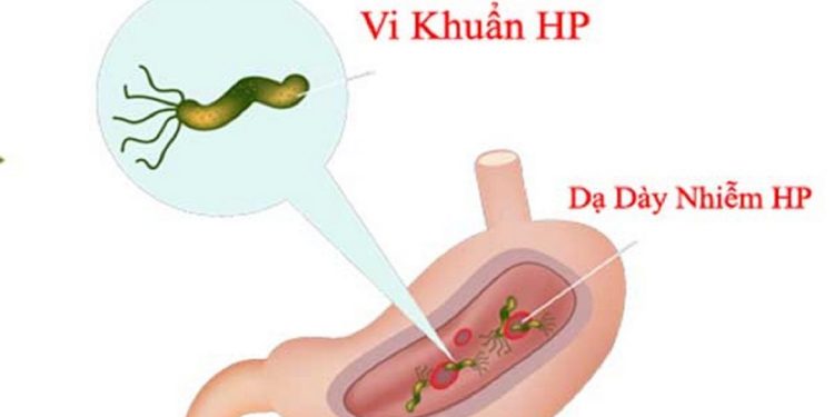 Cach-de-giam-nguy-co-lay-nhiem-vi-khuan-HP-2.jpg