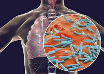 Điều trị Tuberculosis: Thuốc, Phương pháp chữa bệnh và Hồi phục