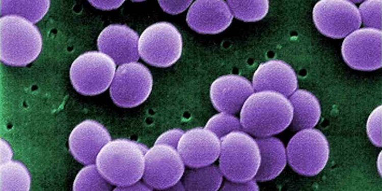 Giới thiệu về Vi khuẩn Staphylococcus aureus