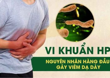 Tìm hiểu về triệu chứng và dấu hiệu nhiễm vi khuẩn HP